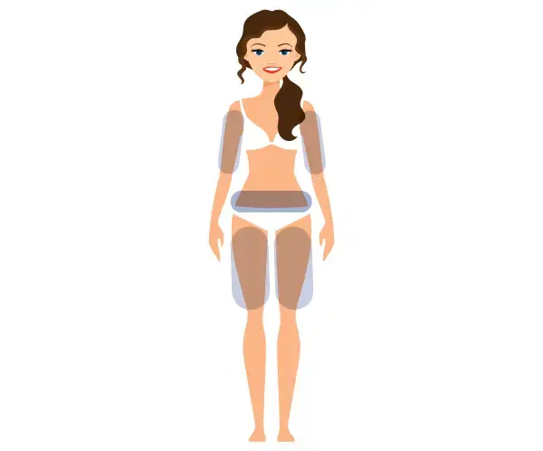 Ilustração dos locais de aplicação